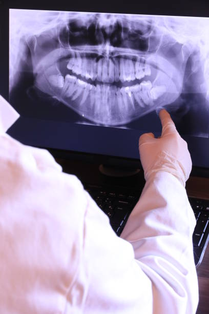 Best Emergency Tooth Extraction in Fowler, MI