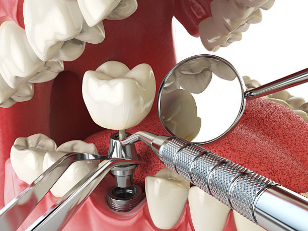 Best Emergency Treatment for Toothache in Fowler, MI